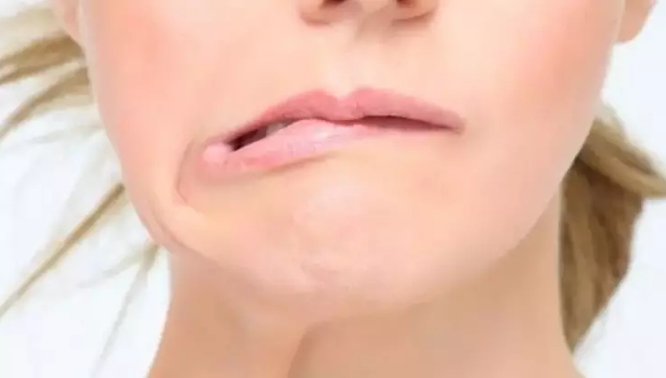 ankara kulak çınlama tedavisi , kulak çınlaması tedavisi ankara